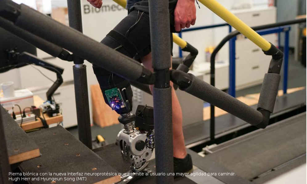 Nueva pierna biónica - Control cerebral sobre la prótesis